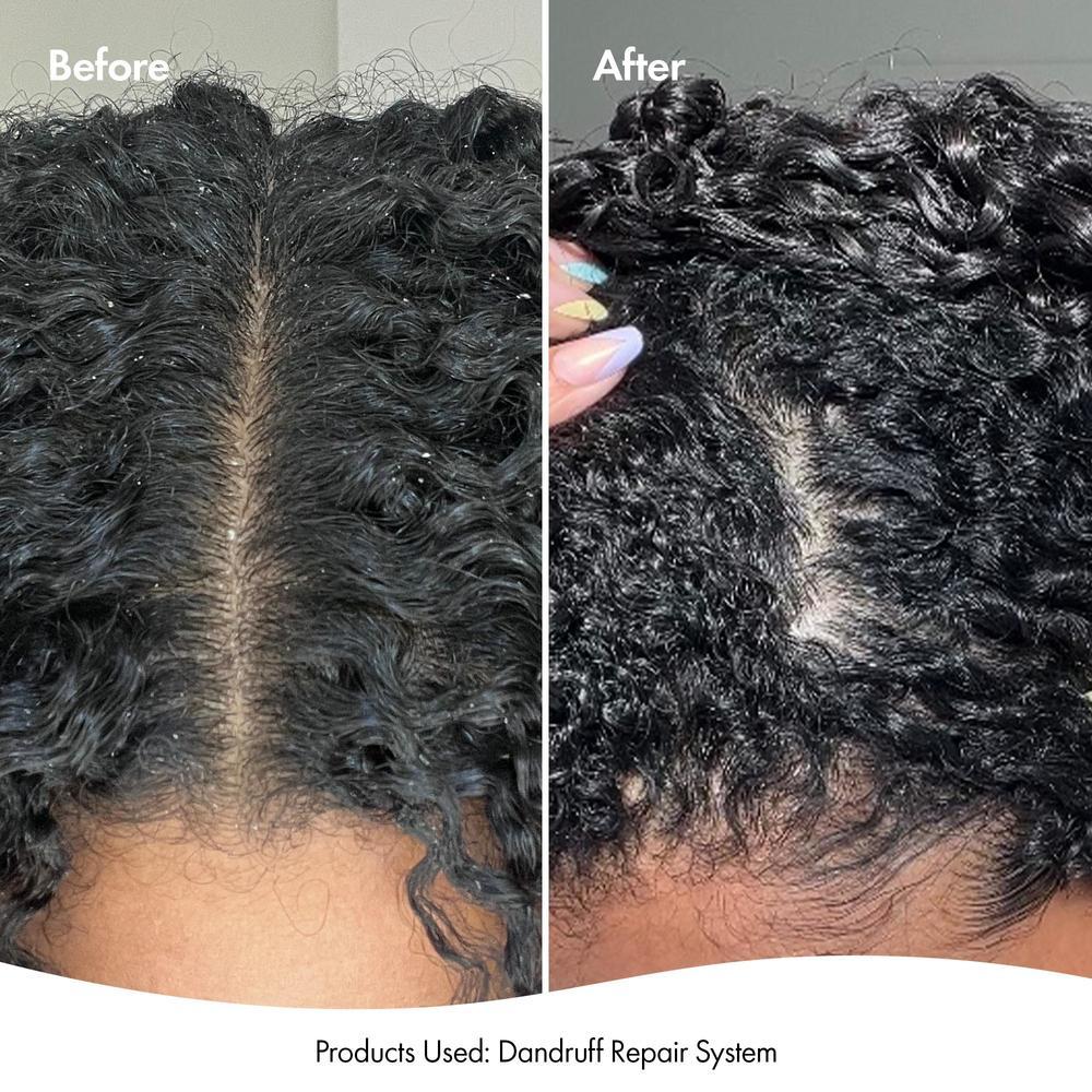 Bondi Boost Dandruff Repair Leave In Scalp Serum 125ml - Image 6
