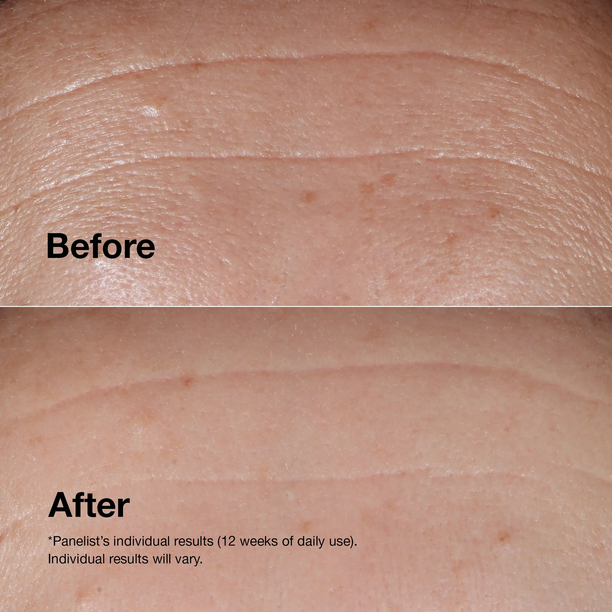 Clinique Smart Clinical Repair Wrinkle Correcting Serum 50ml - Image 3