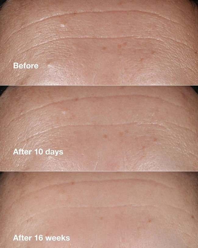 Clinique Smart Clinical Repair Wrinkle Correcting Serum 30ml - Image 3