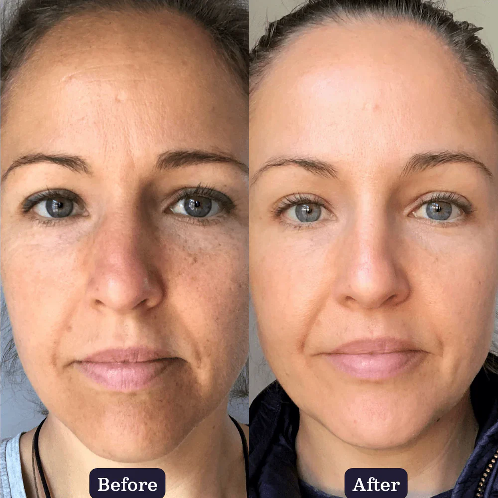 Edible Beauty Collagen Boosting Duo - Image 3
