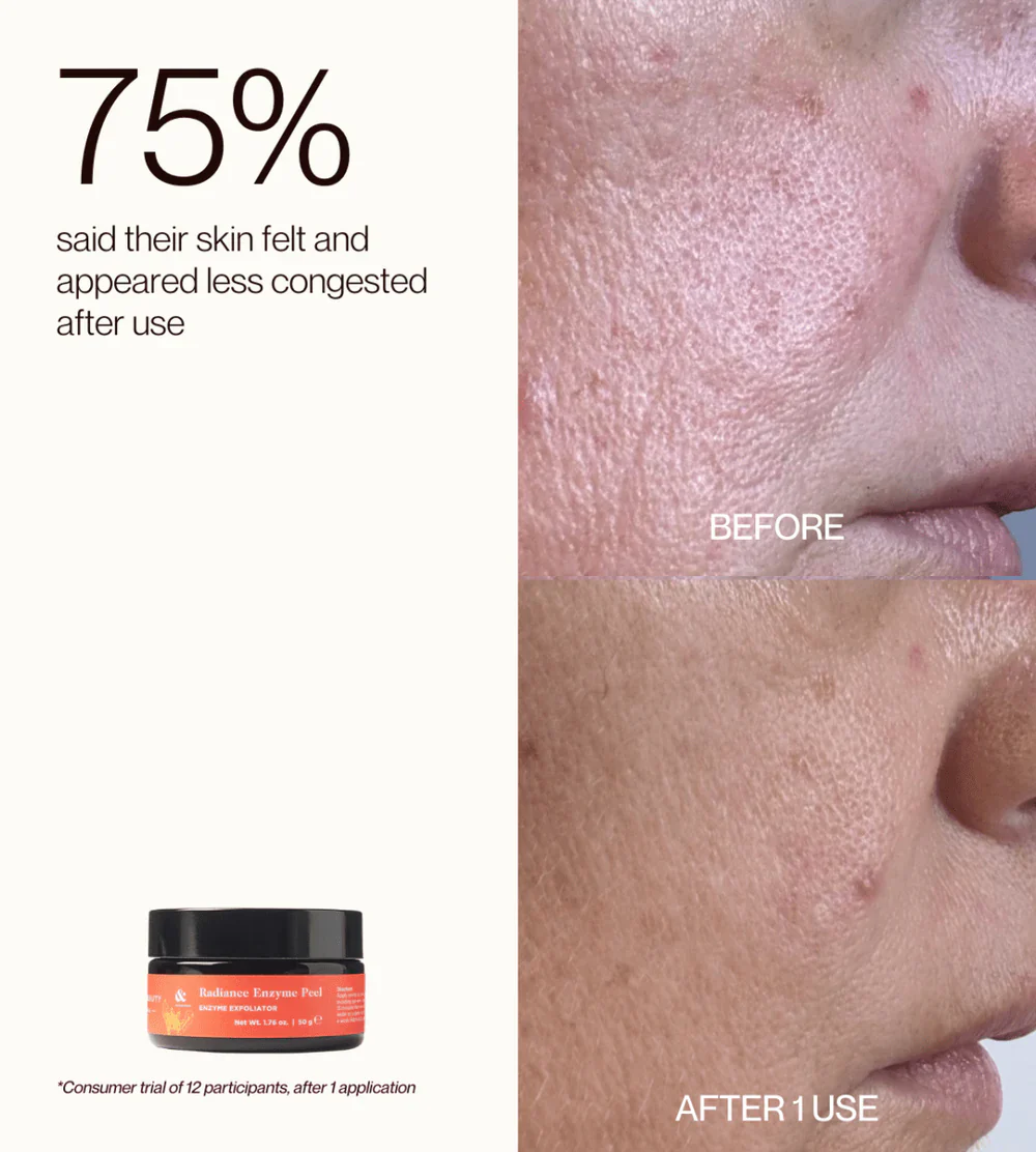 Edible Beauty Radiance Enzyme Peel 50g - Image 6