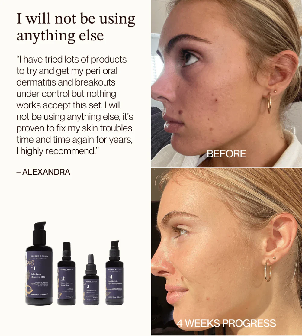 Edible Beauty Starter Skincare Set - Image 4
