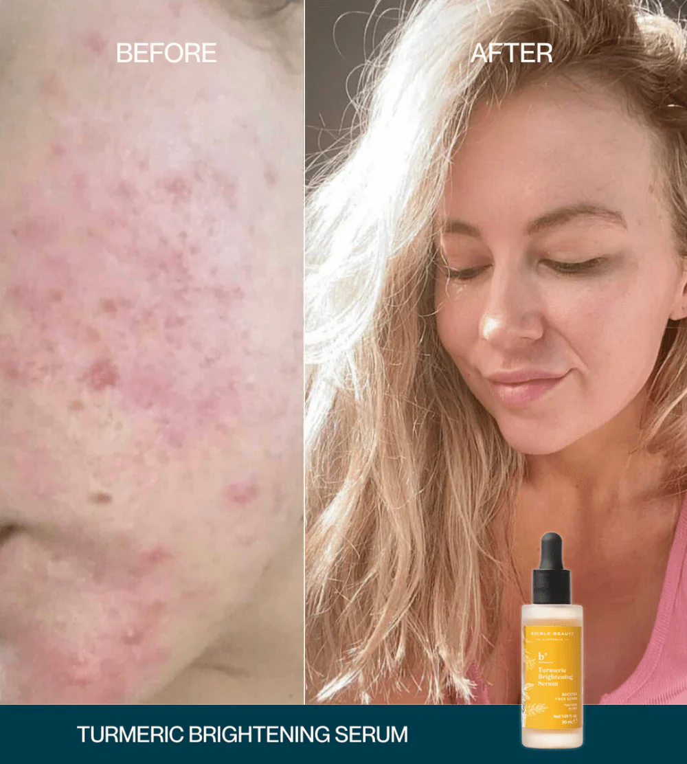 Edible Beauty Turmeric Brightening Serum 30ml - Image 5