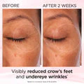 Elizabeth Arden Retinol + HPR Ceramide Rapid Renewing Eye Cream 15ml - Image 5