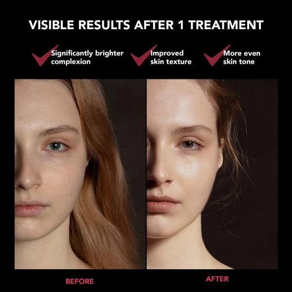 FOREO FAQ 201 LED Face Mask - Image 8