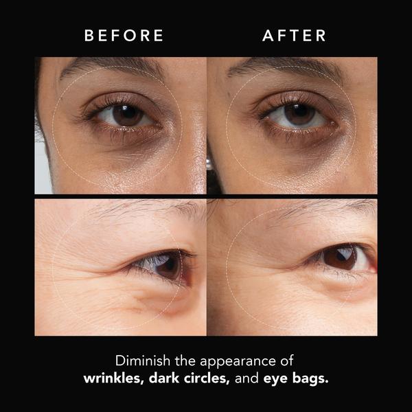 FOREO FAQ Under Eye Microneedling Anti-Wrinkle Hyaluronic Acid Patches 3 Pairs - Image 13