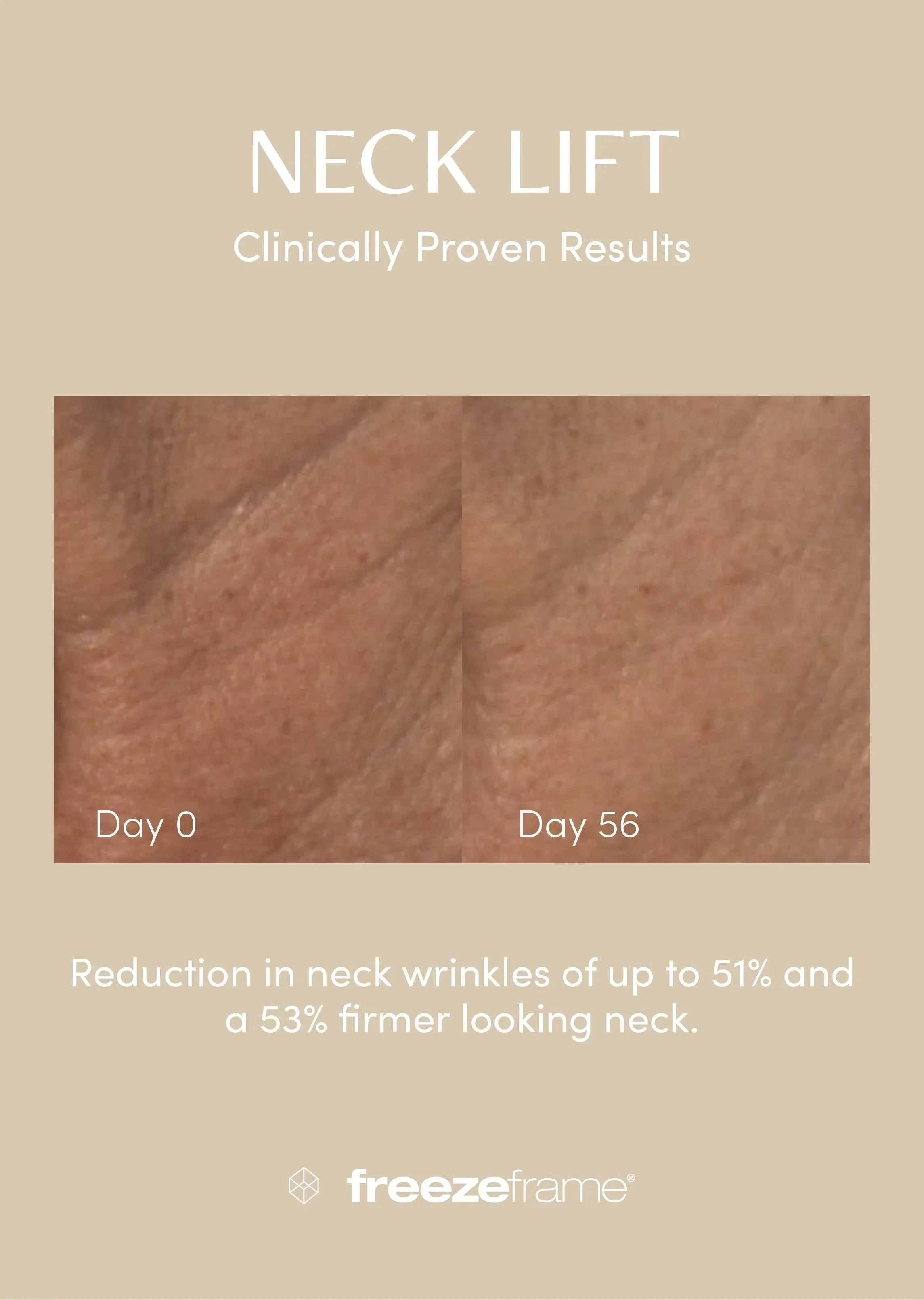 freezeframe Neck Lift 50ml - Image 4