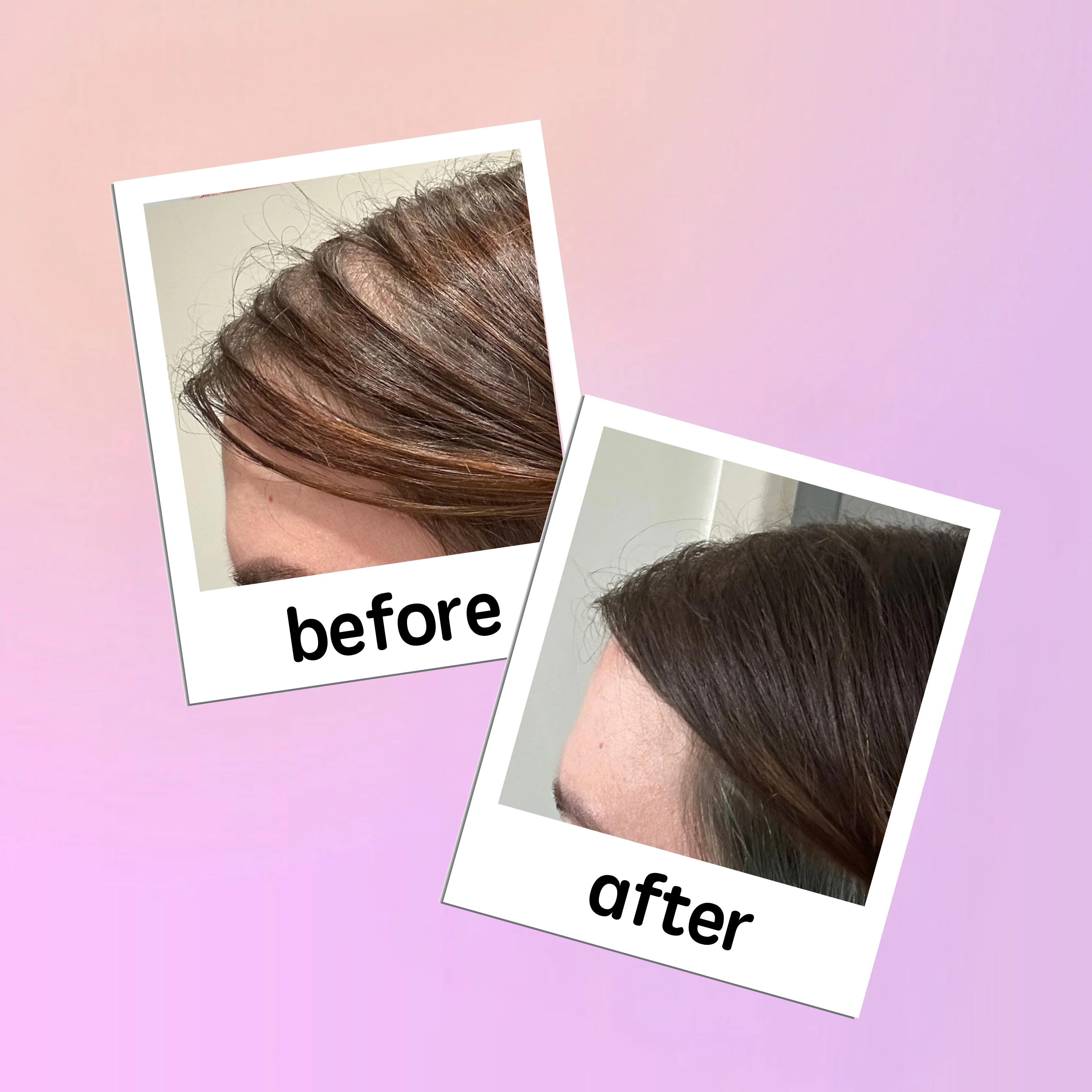 georgiemane Hair Growth Capsules x120 - Image 3