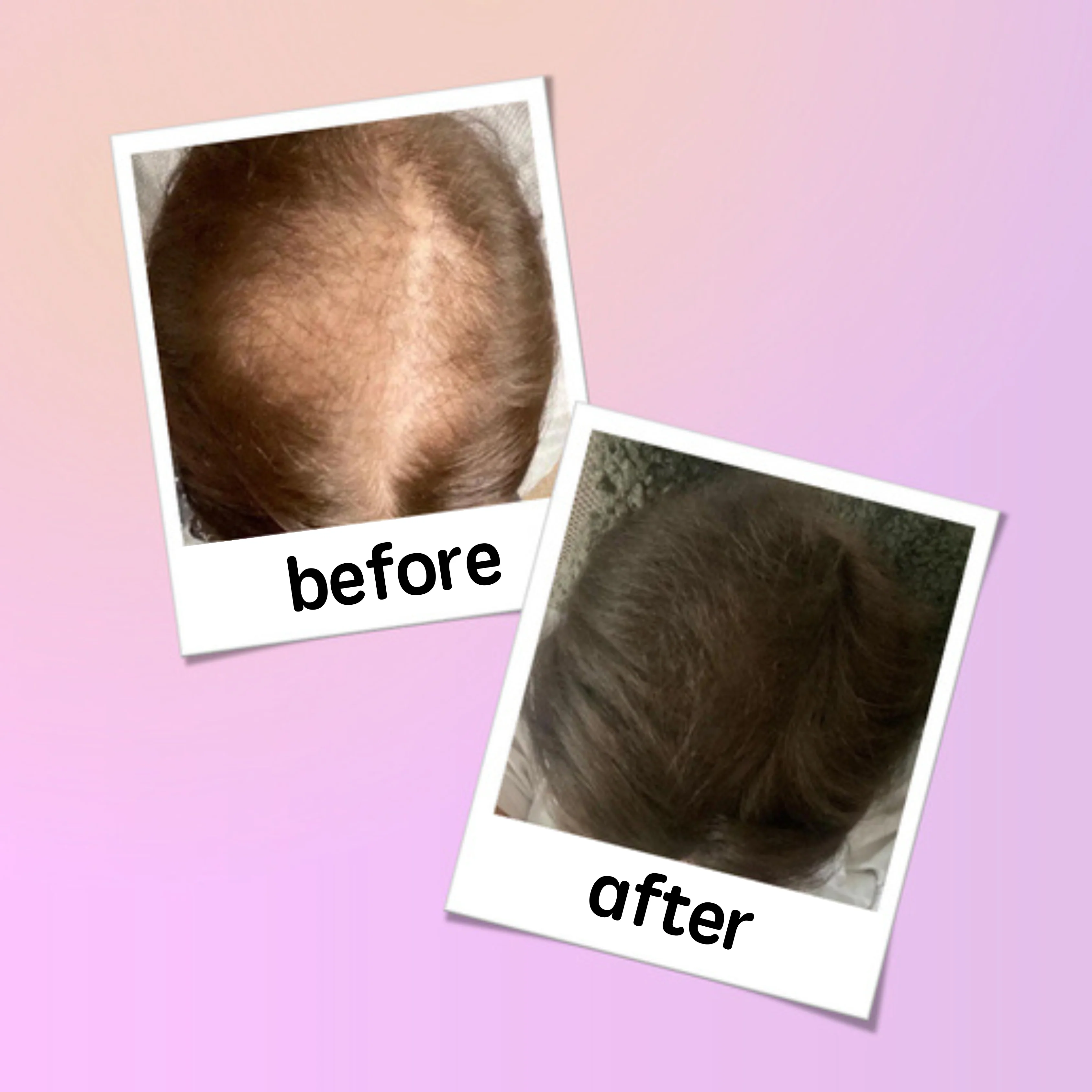 georgiemane Hair Growth Spray 100ml - Image 5