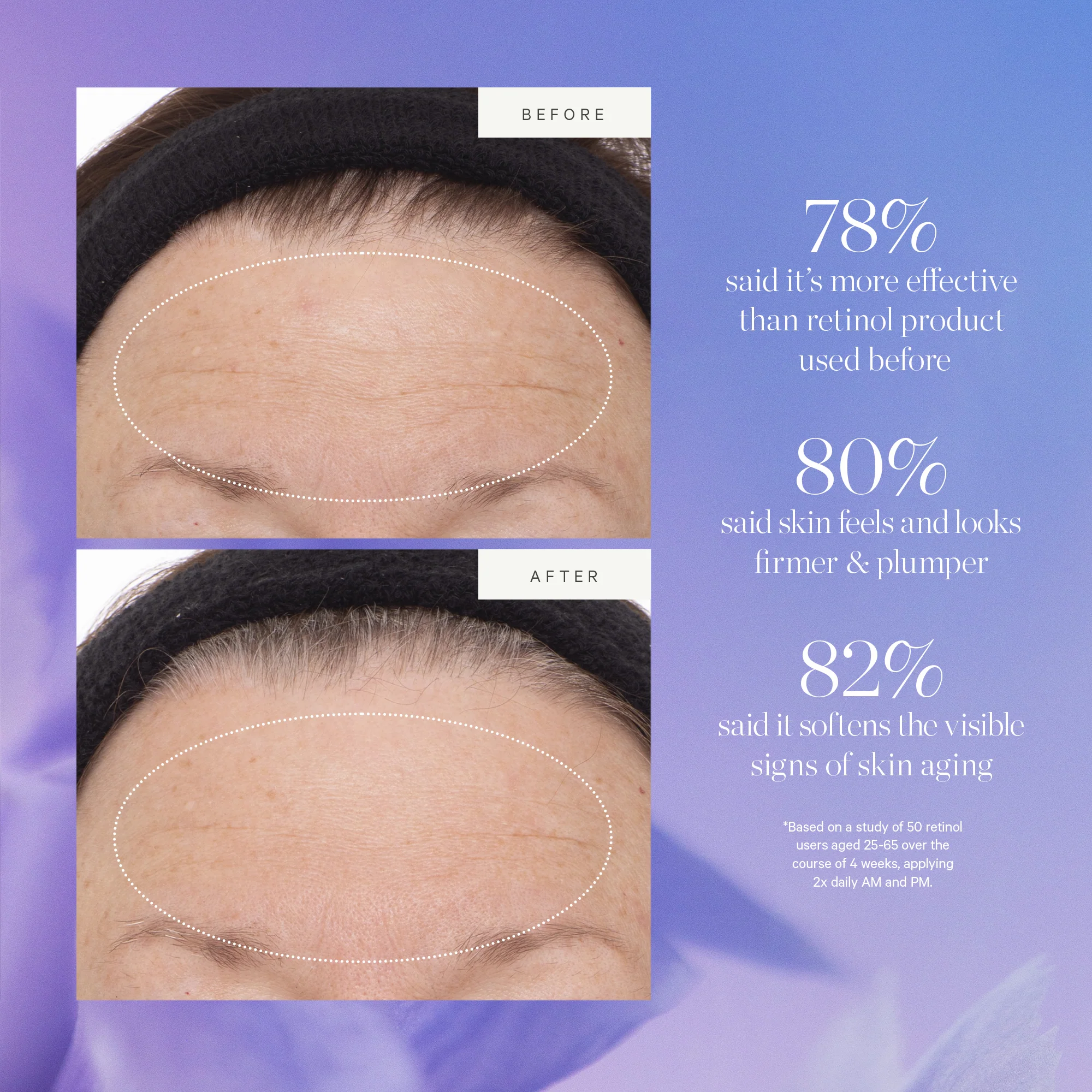 KORA Organics Plant Stem Cell Retinol Alternative Serum 10ml - Image 9