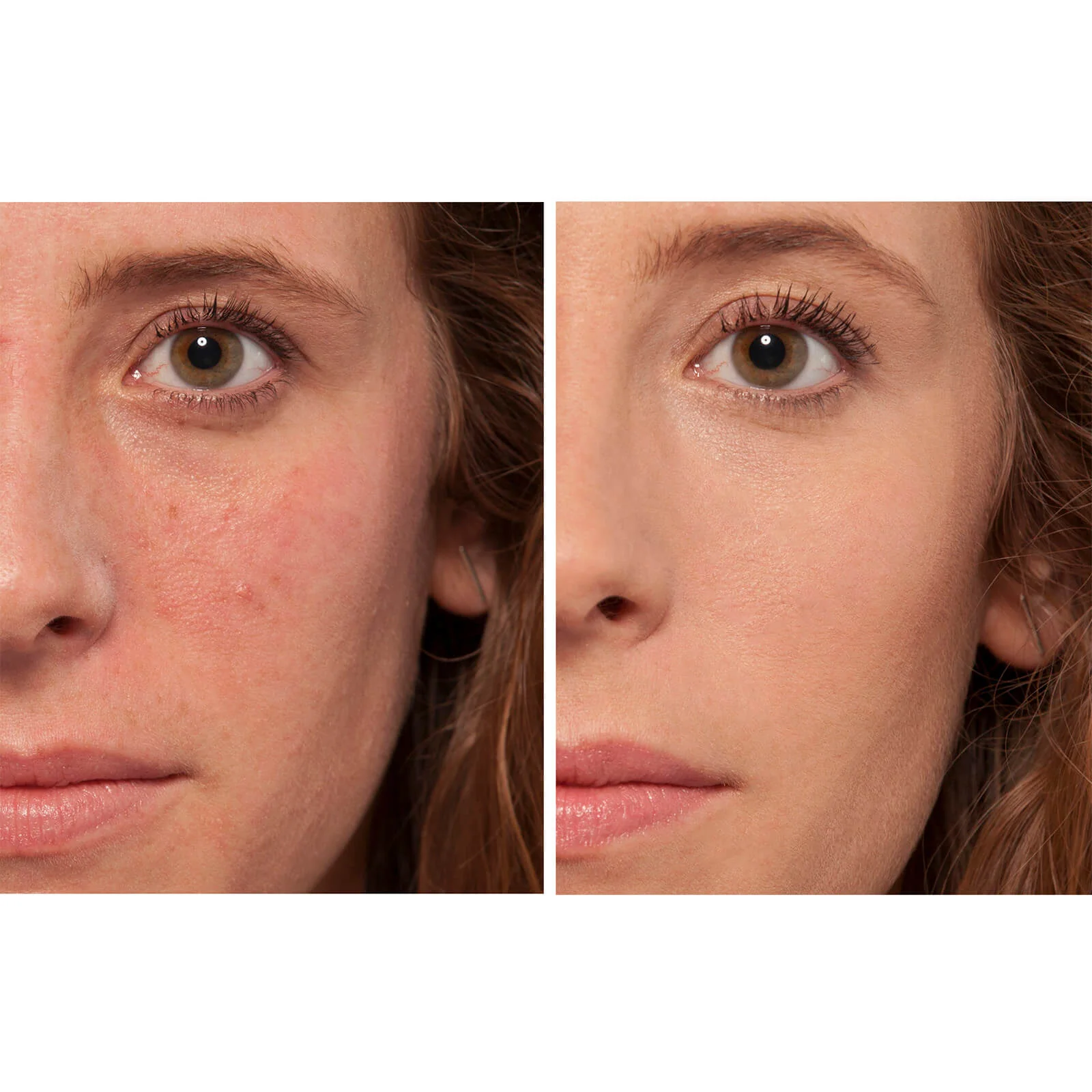 L'Oréal Paris True Match The One Concealer 6.8ml (Various Shades) - Image 3