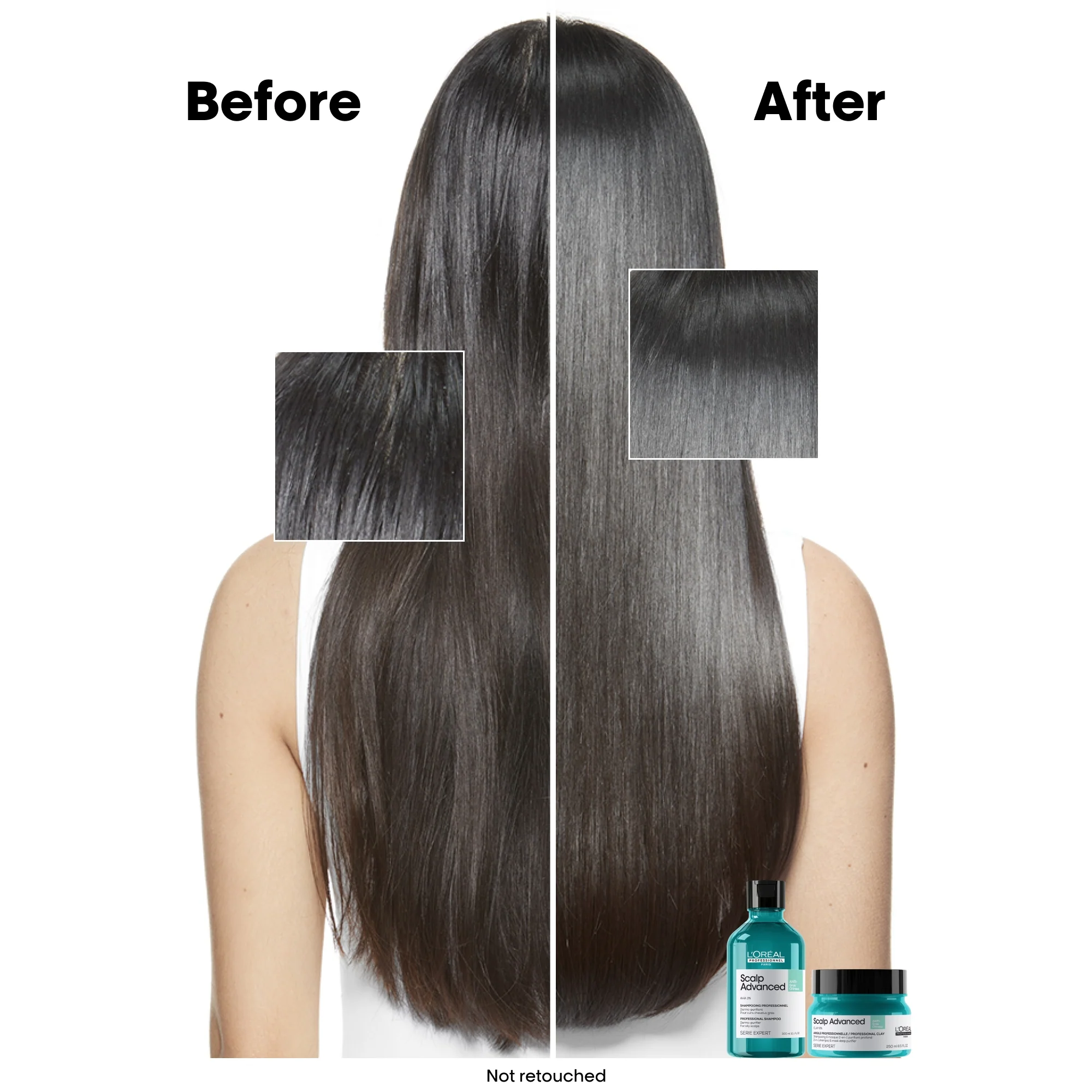 L'Oréal Professionnel Serié Expert Scalp Advanced Anti-Oiliness 2-in-1 Deep Purifier Clay Hair Mask 250ml - Image 3