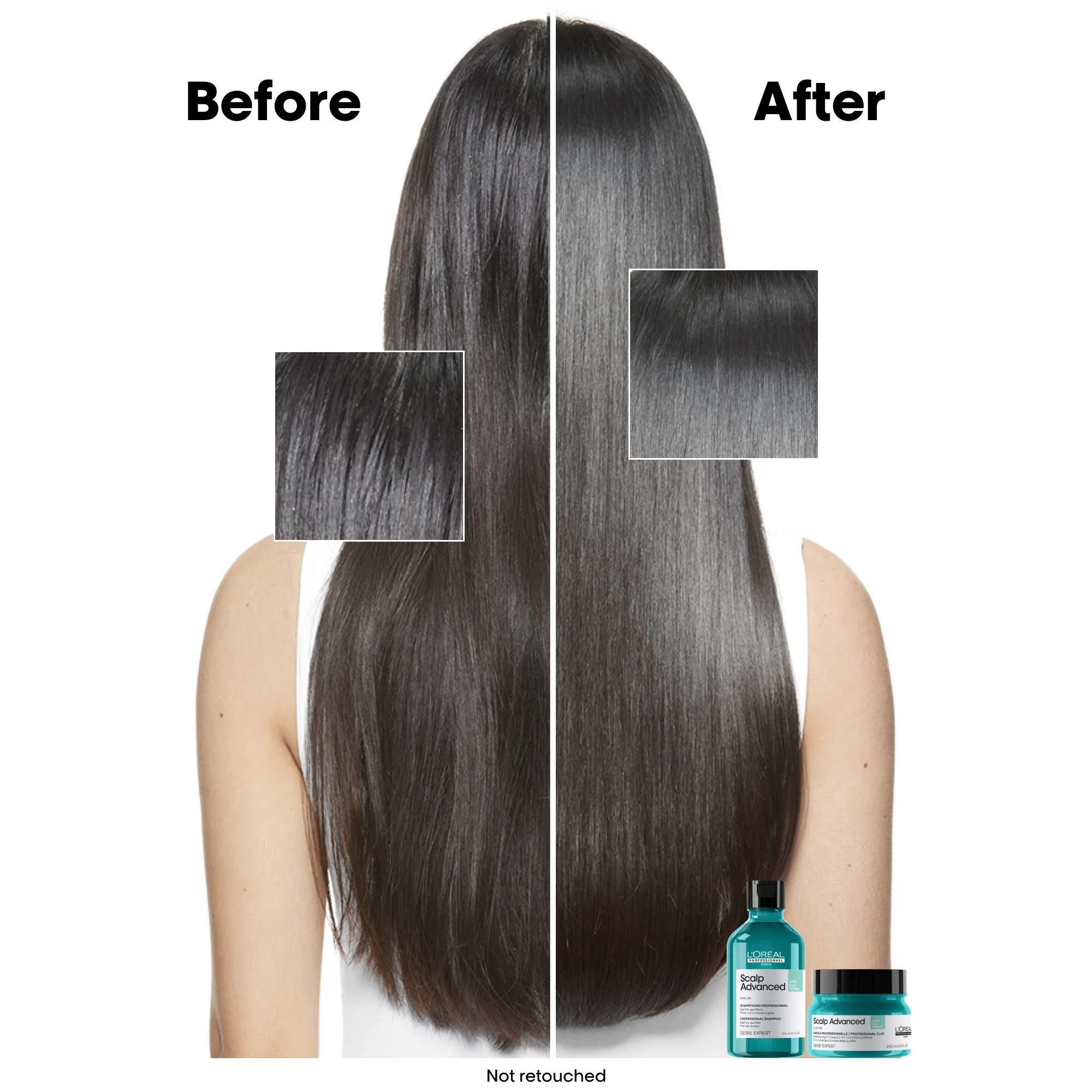 L'Oréal Professionnel Serié Expert Scalp Advanced Anti-Oiliness Dermo-Purifier Shampoo 300ml - Image 3