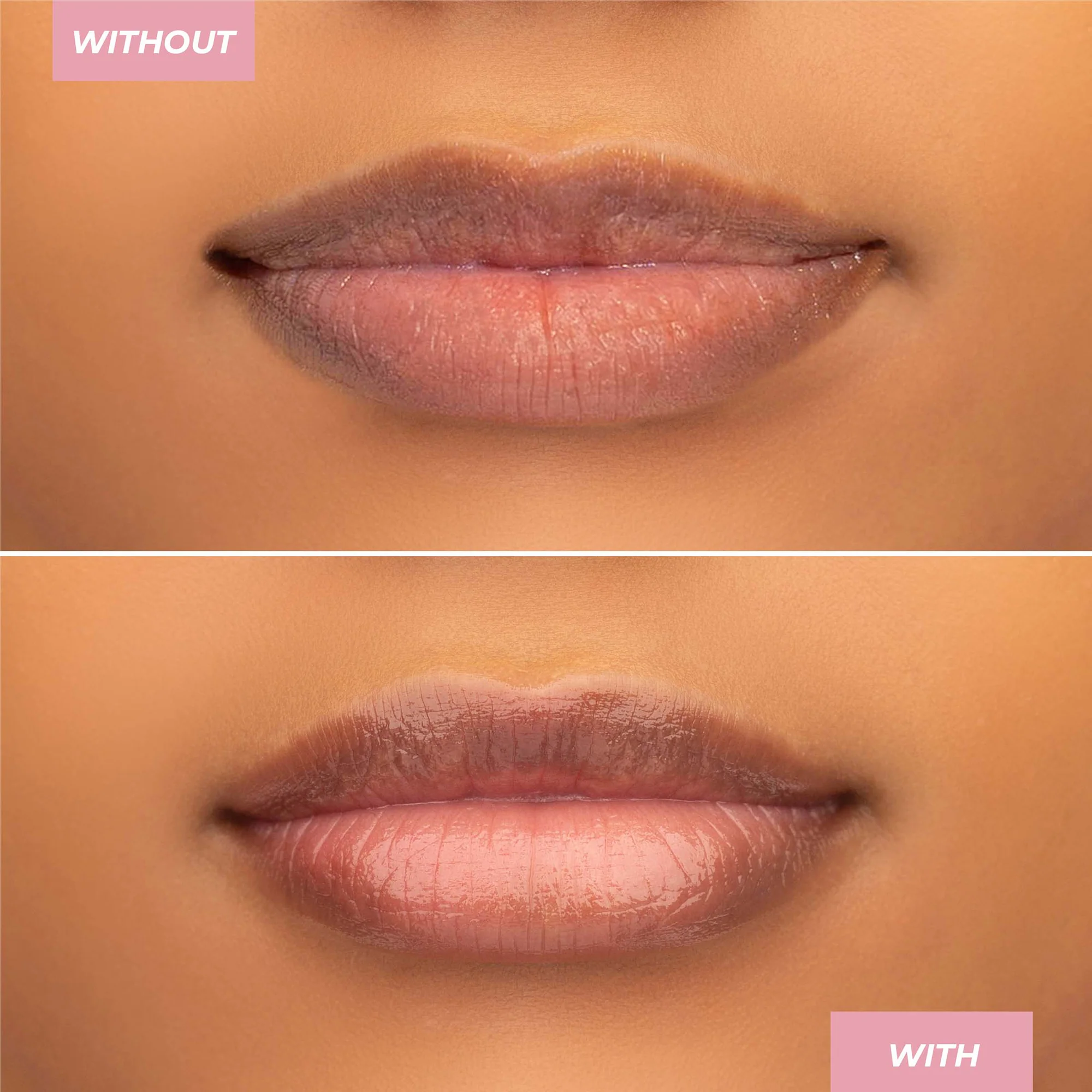 MCoBeauty Hyaluronic Ultra-Treatment Lip Balm 4g - Clear - Image 4