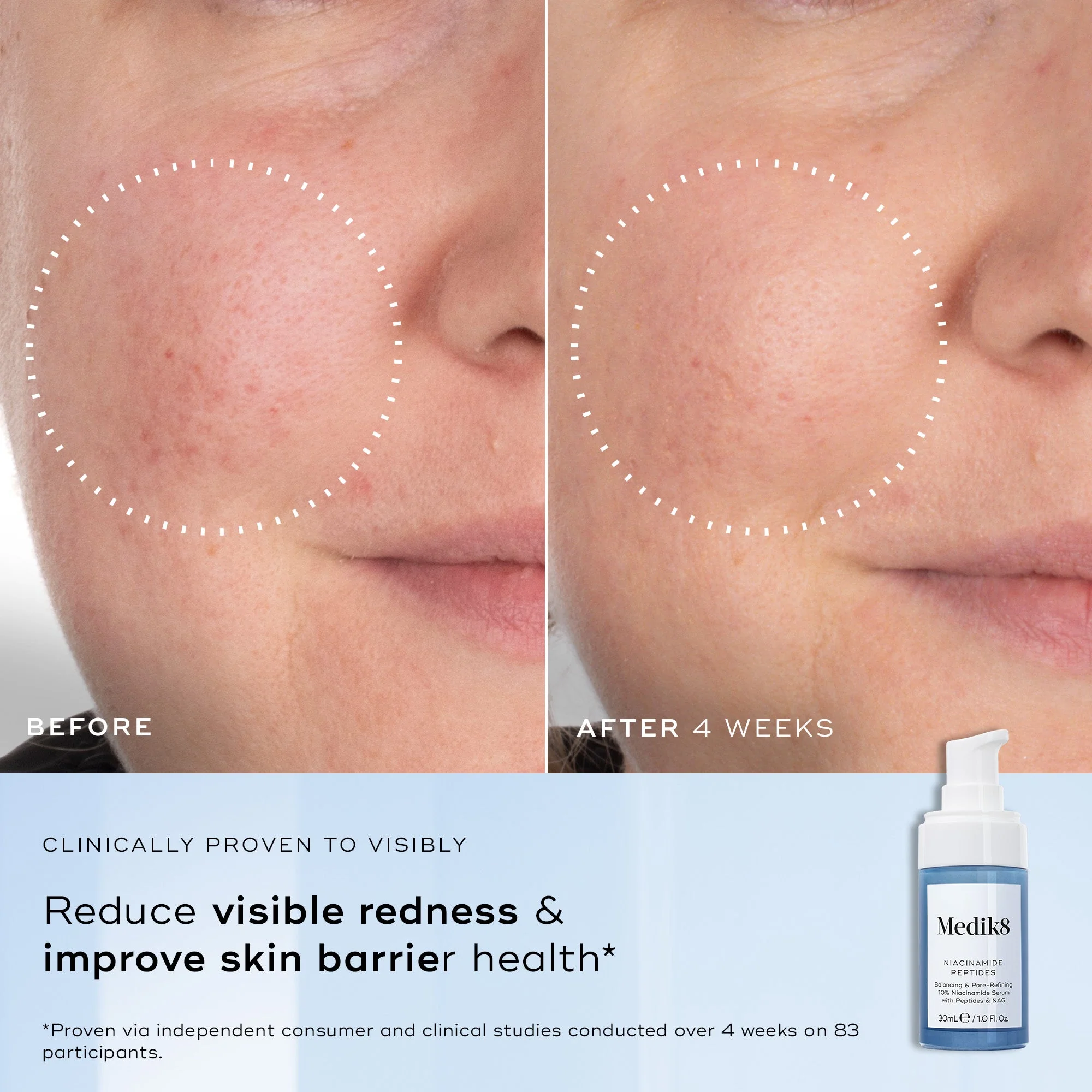 Medik8 Niacinamide Peptides 30ml - Image 4
