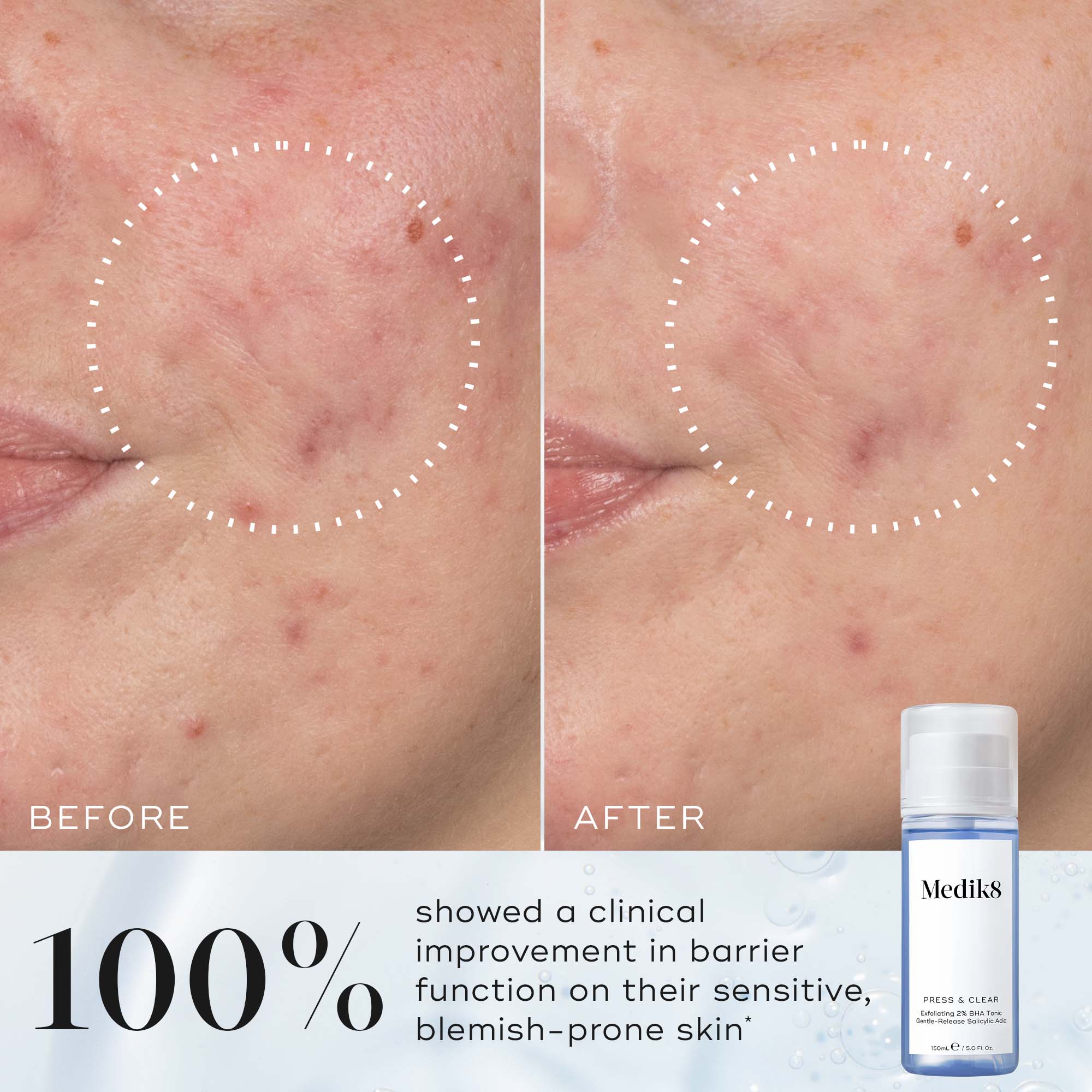 Medik8 Press and Clear 150ml - Image 5