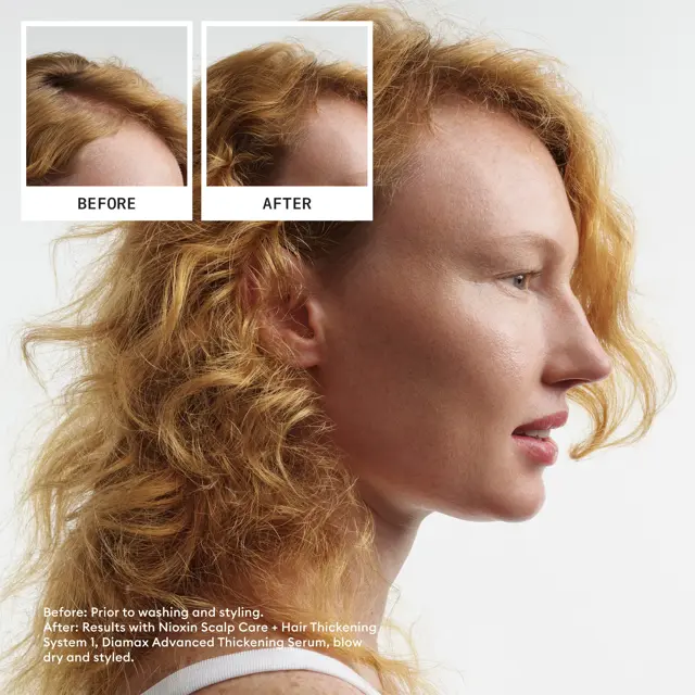 Nioxin Scalp + Hair Thickening System 1 Full Size Kit - Image 6