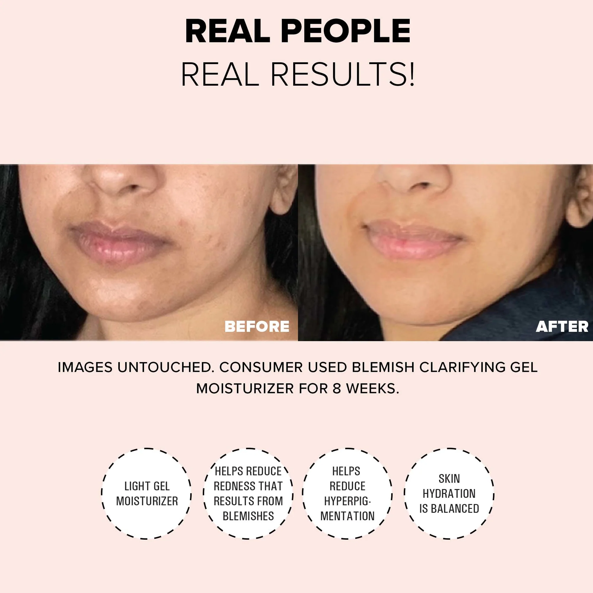 NUDESTIX NUDESKIN Blemish Clarifying Gel Moisturiser 60ml - Image 5