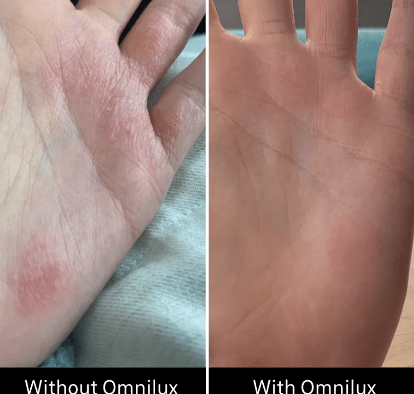 Omnilux Contour Glove - Image 10