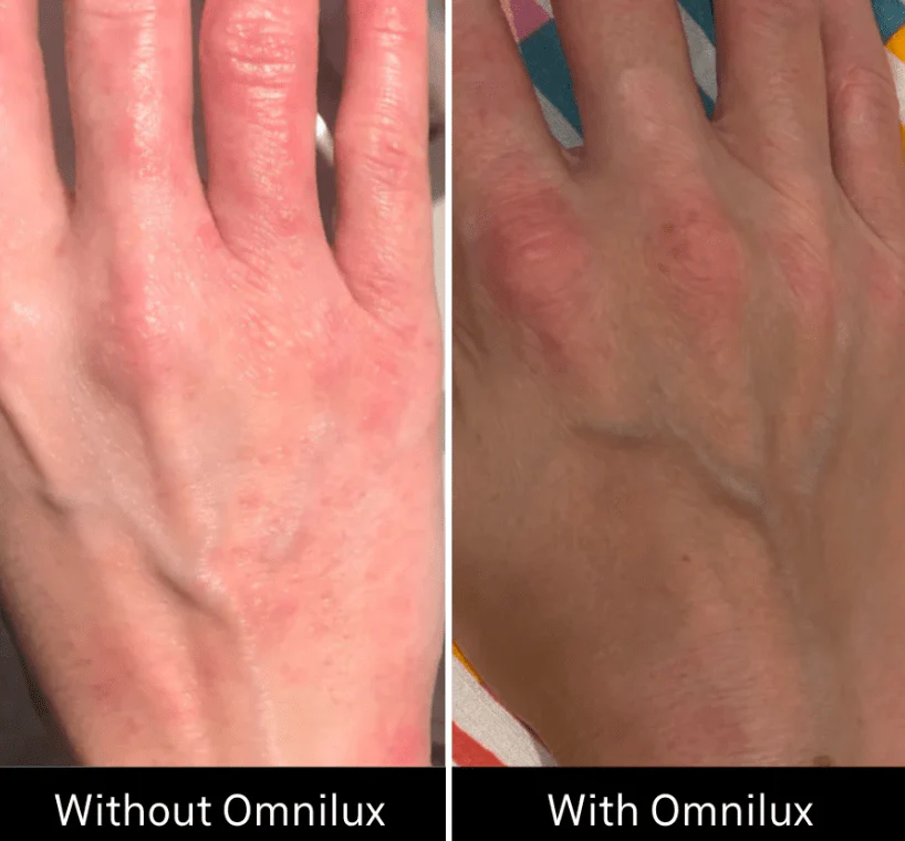 Omnilux Contour Glove - Image 12