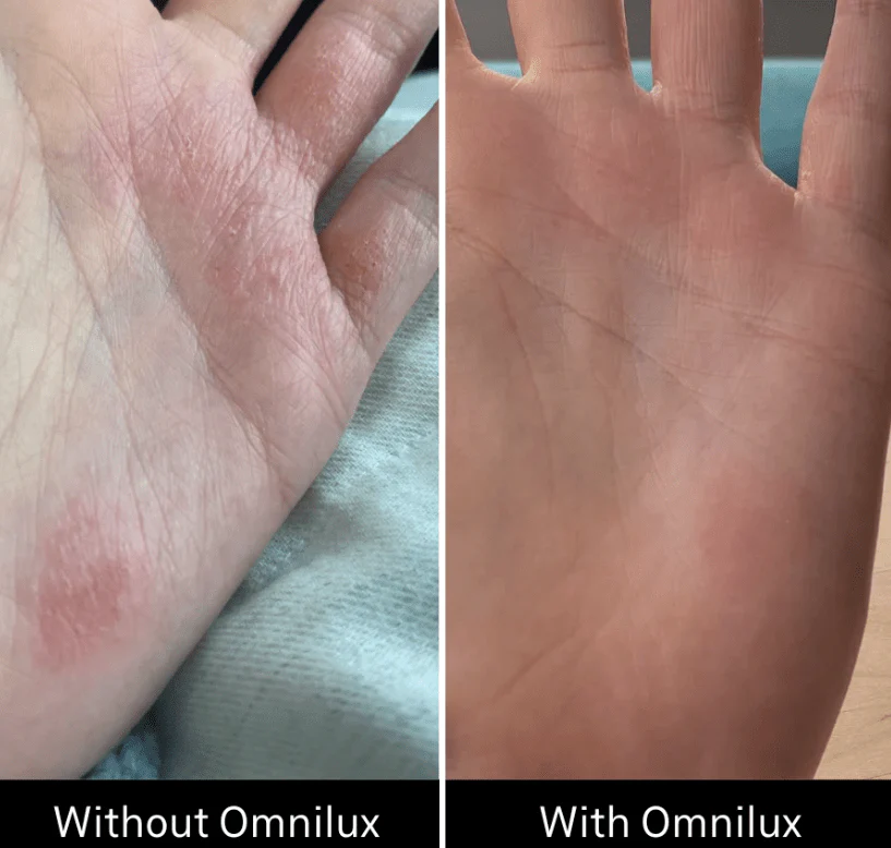 Omnilux Contour Glove - Image 3