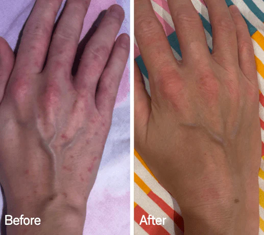 Omnilux Contour Glove - Image 4
