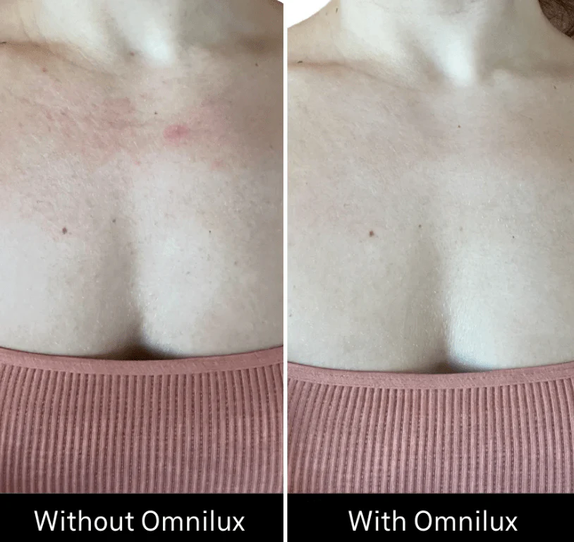 Omnilux Contour Neck & Décolleté - Image 2