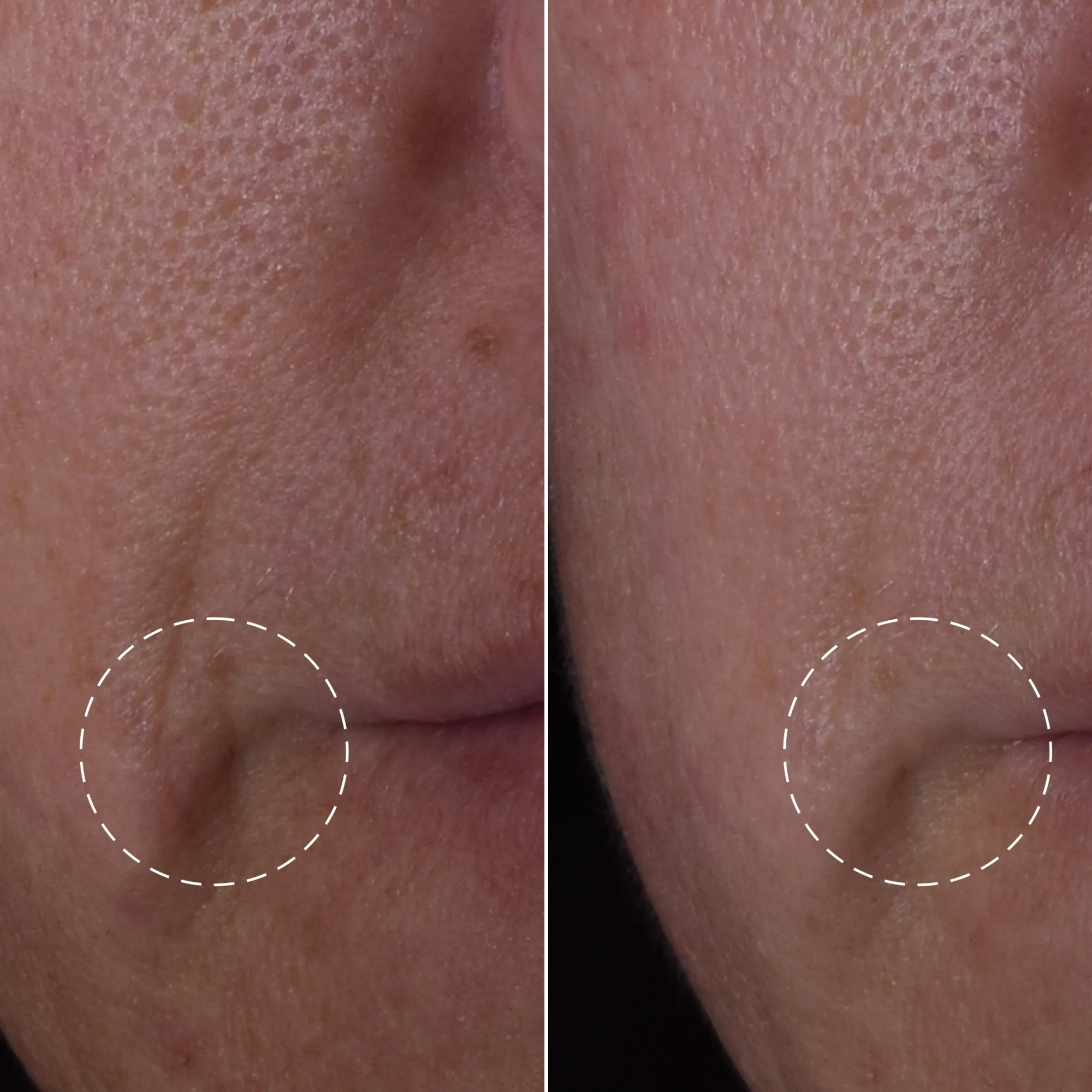 philosophy Serums & Treatments Dose of Wisdom Bouncy Skin Reactivating Serum 30ml - Image 3