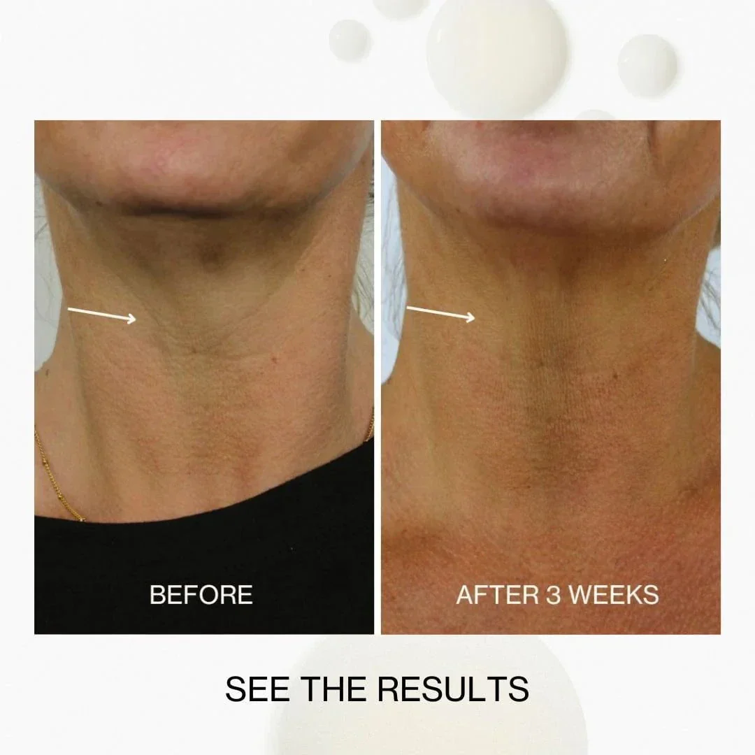 The Jojoba Company Neck & Decolletage Lifting Concentrate 30ml - Image 5