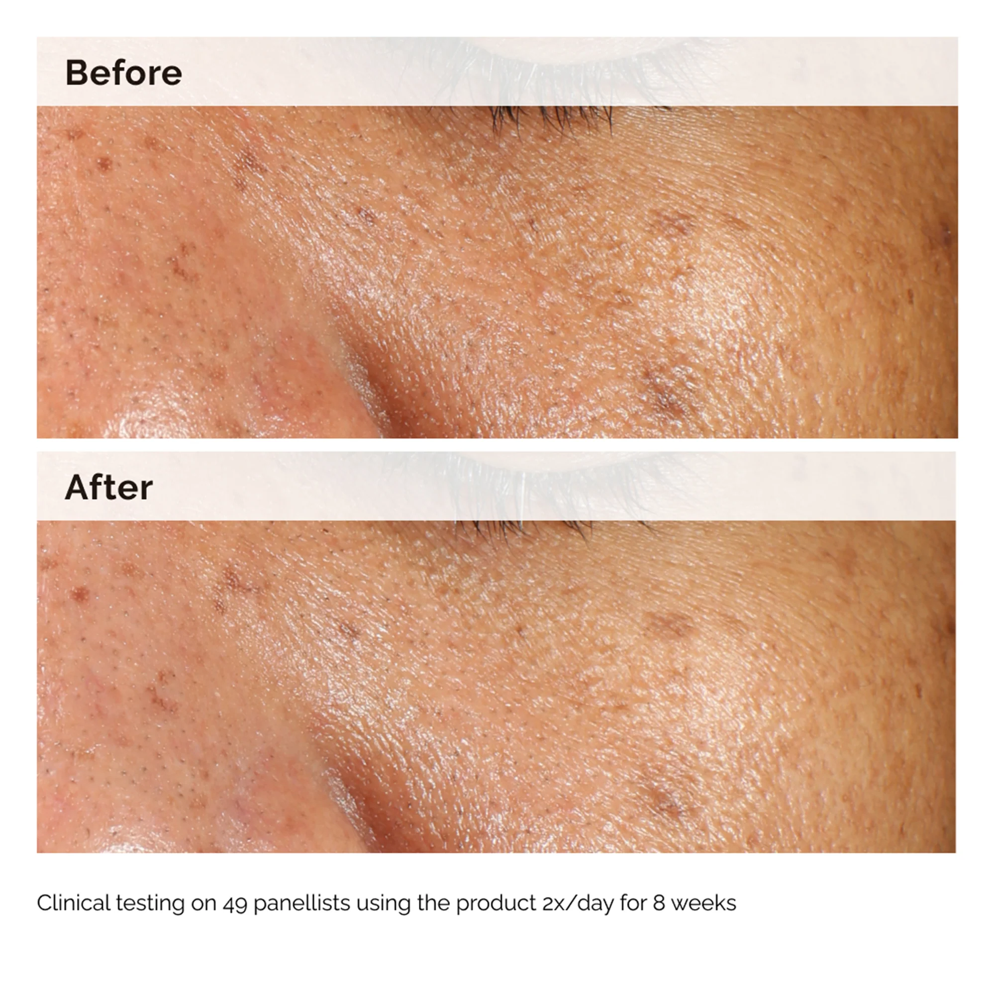 The Ordinary Alpha Arbutin 2% + HA 30ml - Image 9