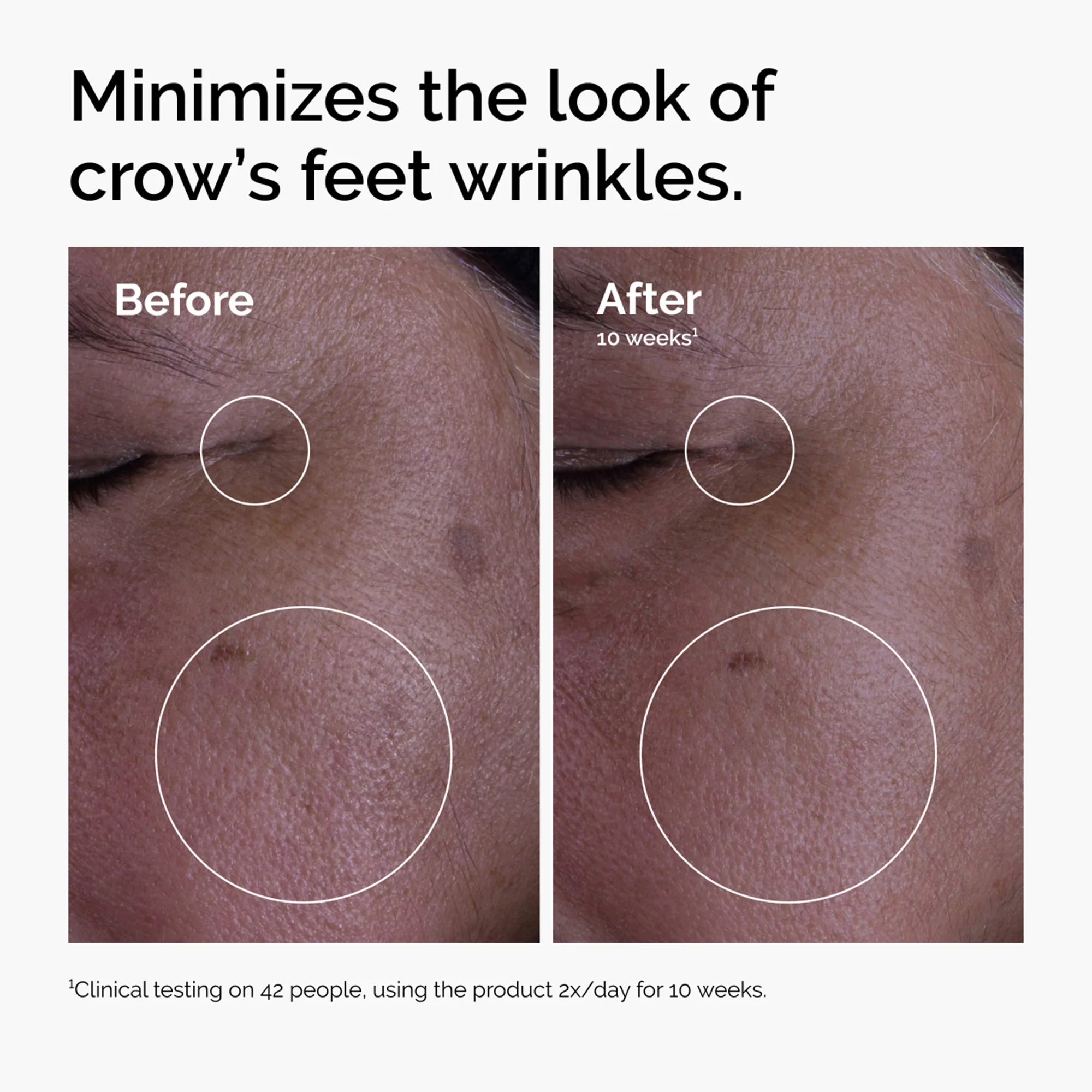 The Ordinary GF 15% Solution 30ml - Image 3