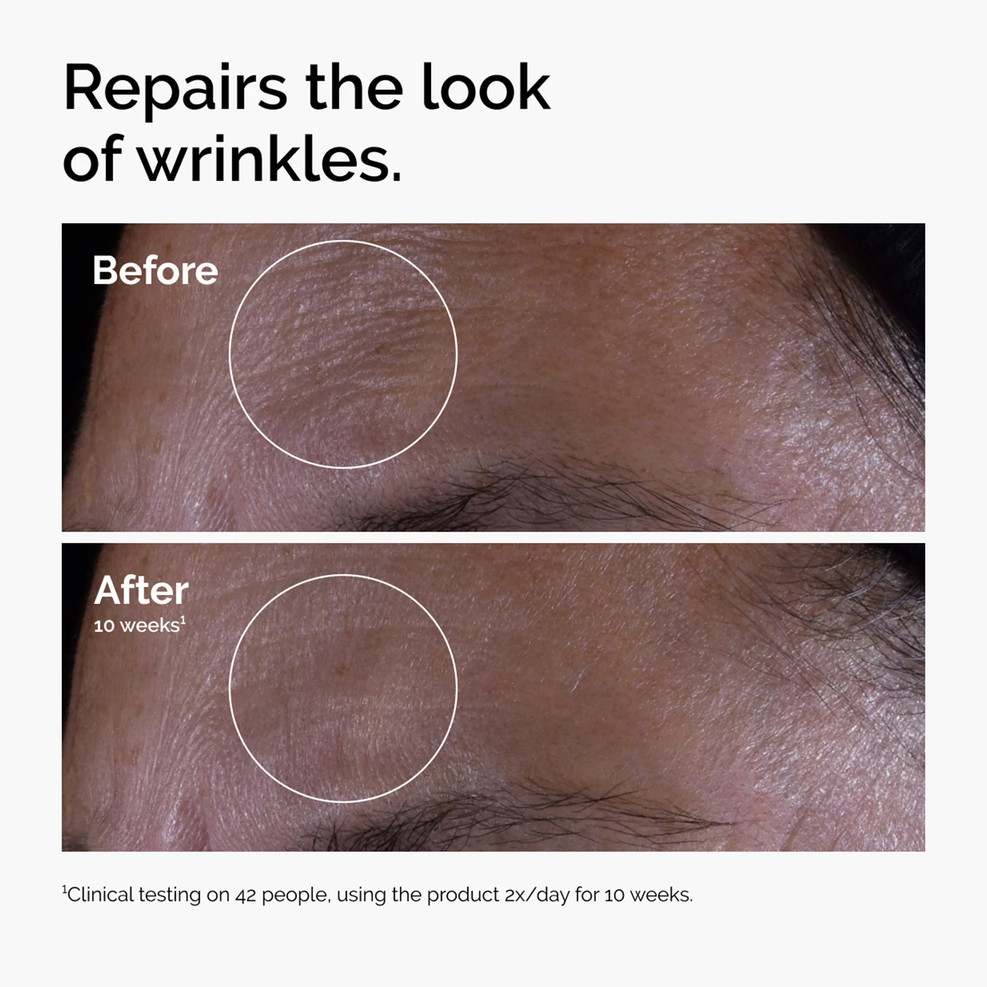 The Ordinary GF 15% Solution 30ml - Image 5