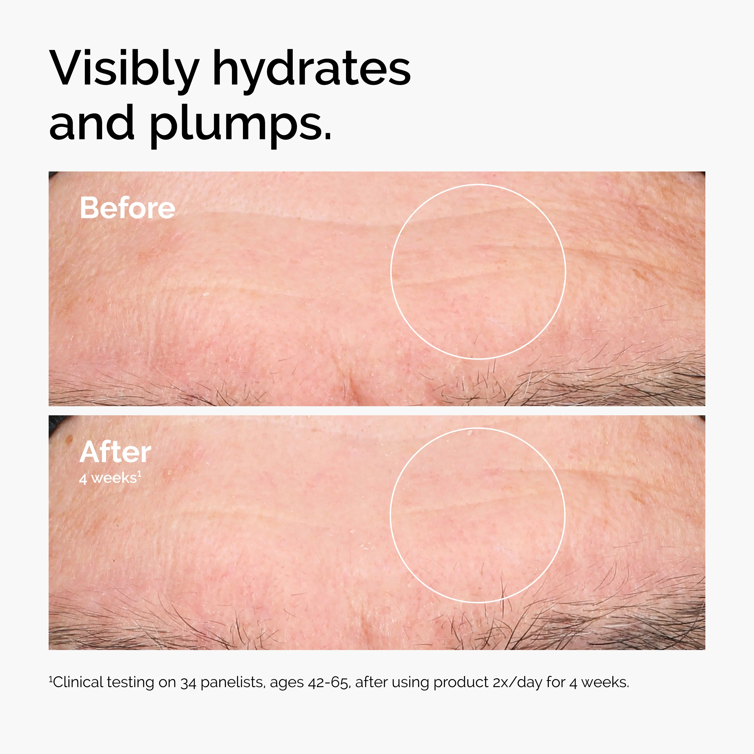 The Ordinary Hyaluronic Acid 2% + B5 30ml - Image 6