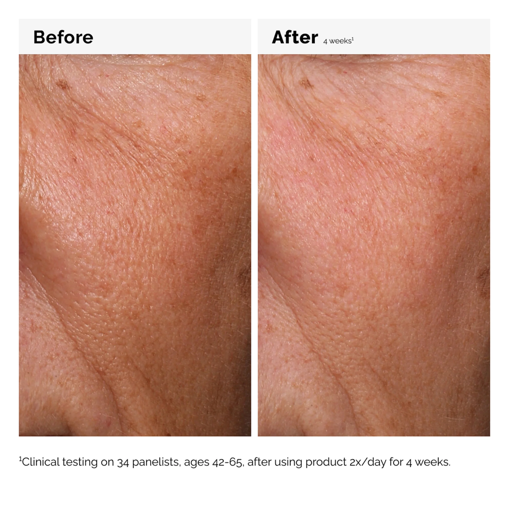 The Ordinary Hyaluronic Acid 2% + B5 60ml - Image 9