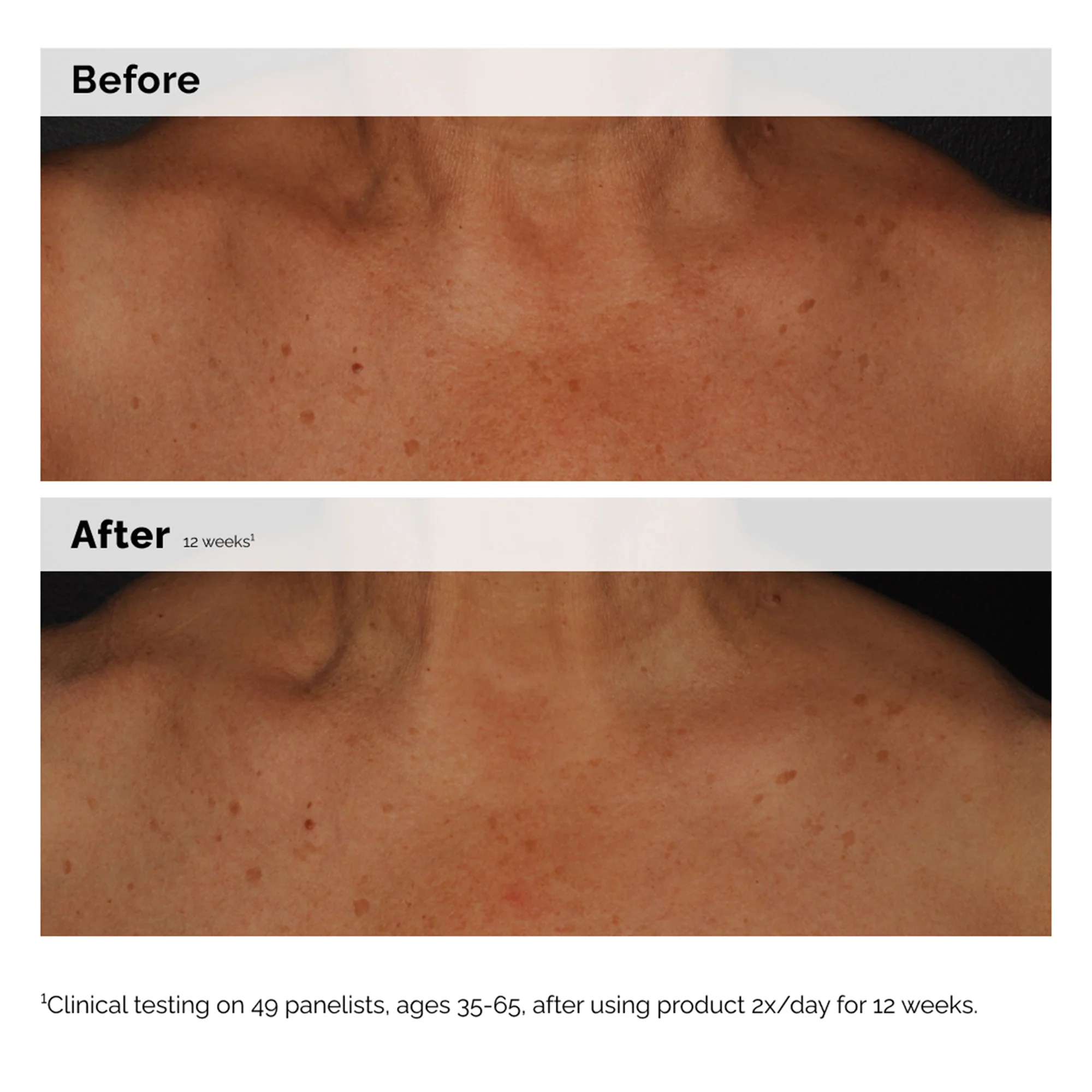 The Ordinary Niacinamide 5% Face and Body Emulsion 100ml - Image 3