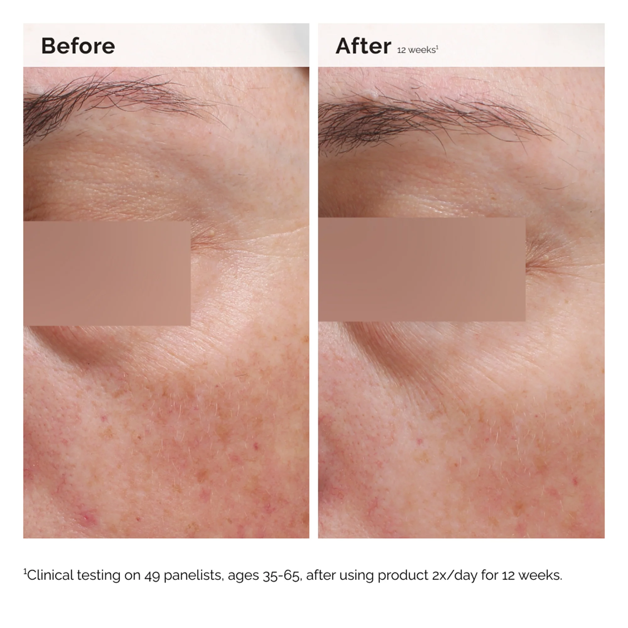 The Ordinary Niacinamide 5% Face and Body Emulsion 100ml - Image 7