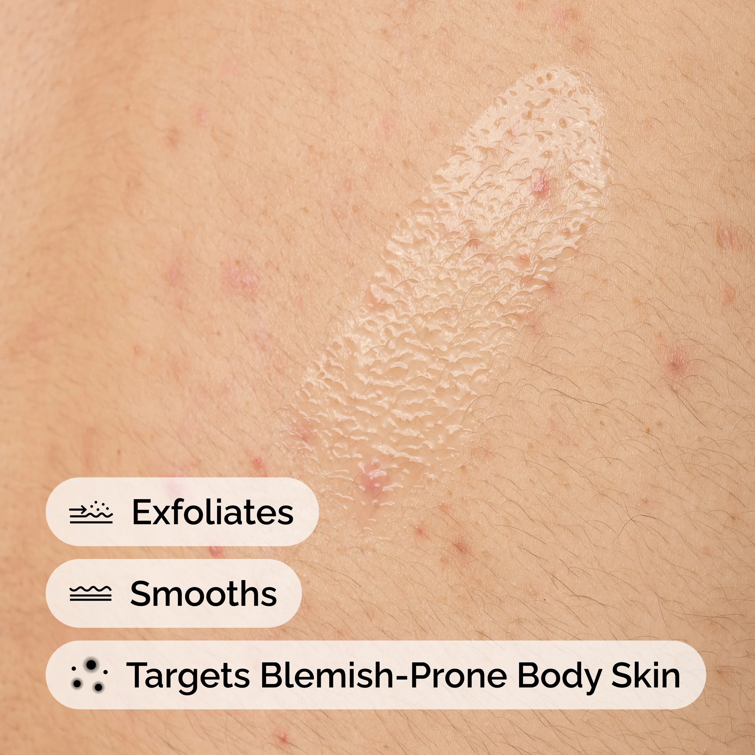 The Ordinary Salicylic Acid 0.5% Body Serum 240ml - Image 4