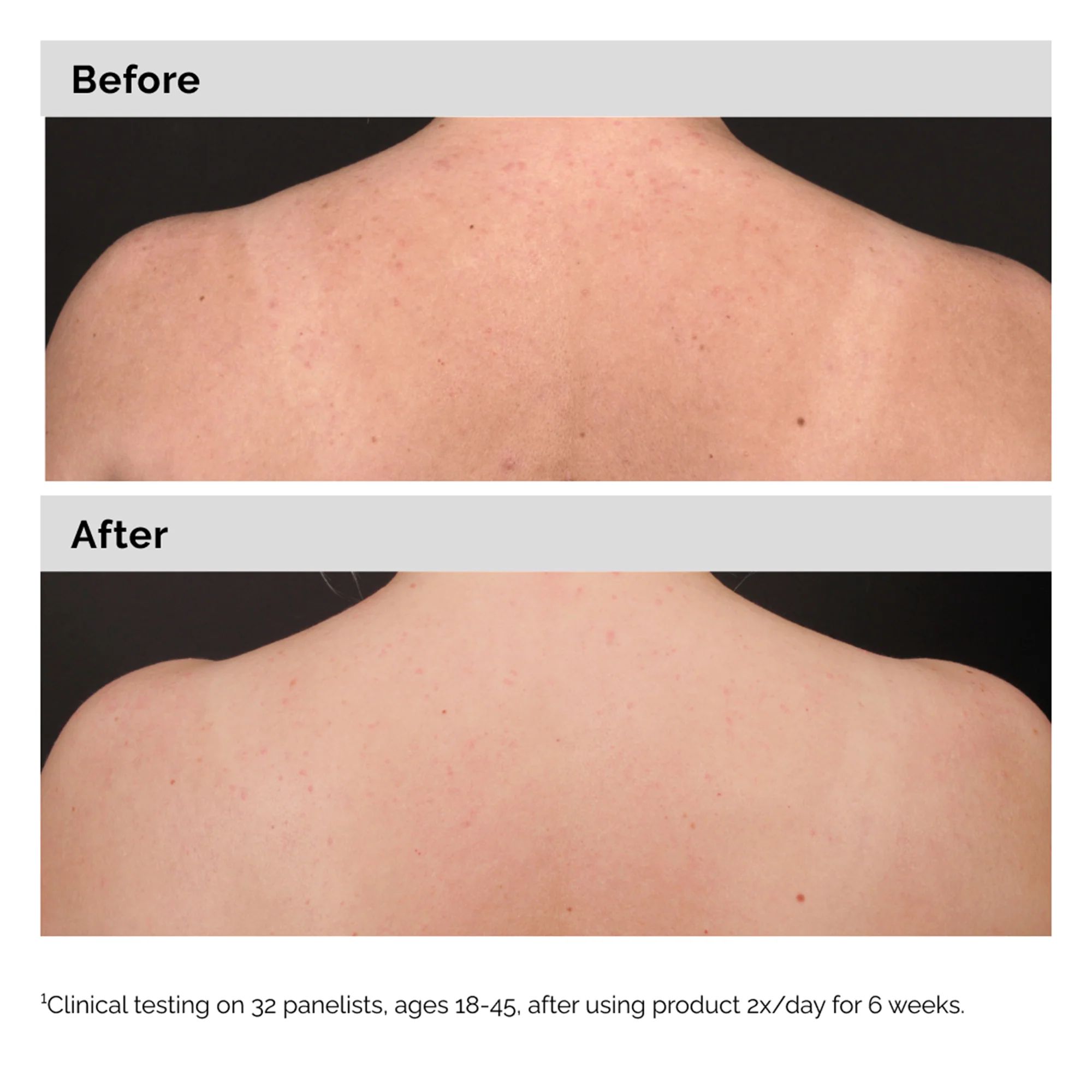 The Ordinary Salicylic Acid 0.5% Body Serum 240ml - Image 5