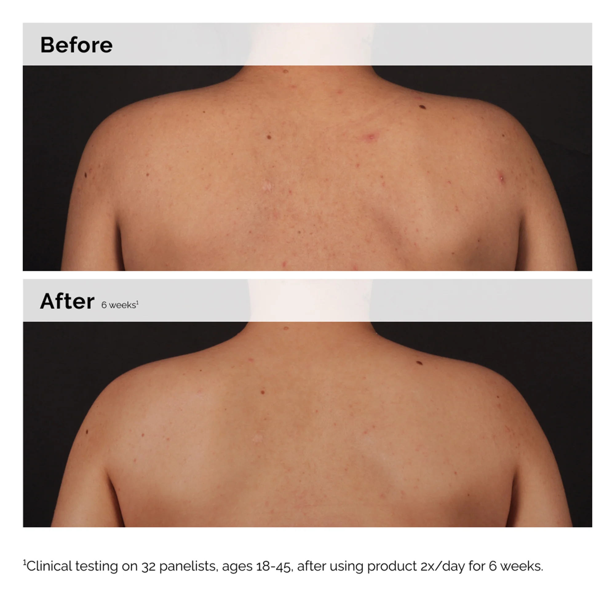The Ordinary Salicylic Acid 0.5% Body Serum 240ml - Image 6