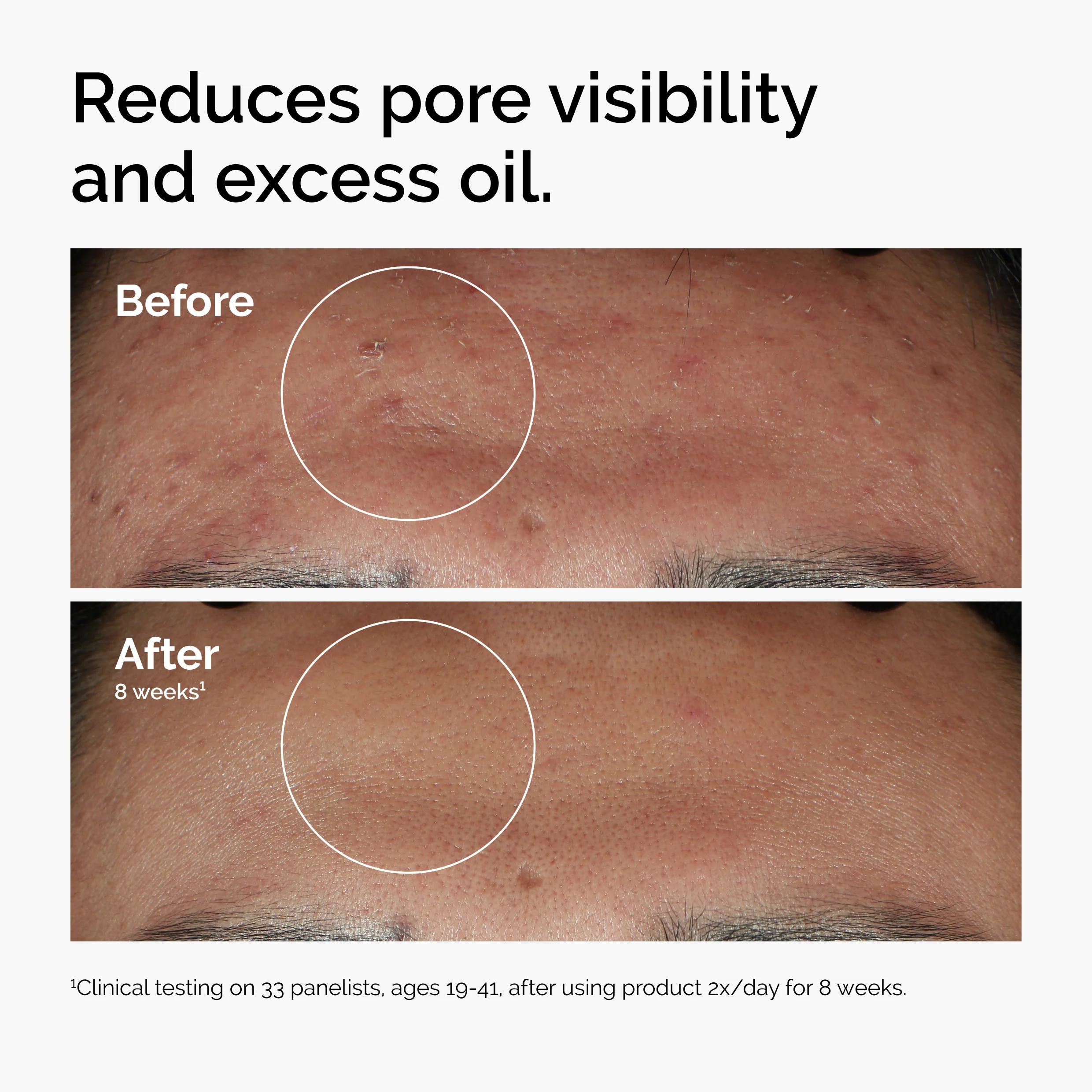 The Ordinary Niacinamide 10% + Zinc 1% 60ml - Image 9