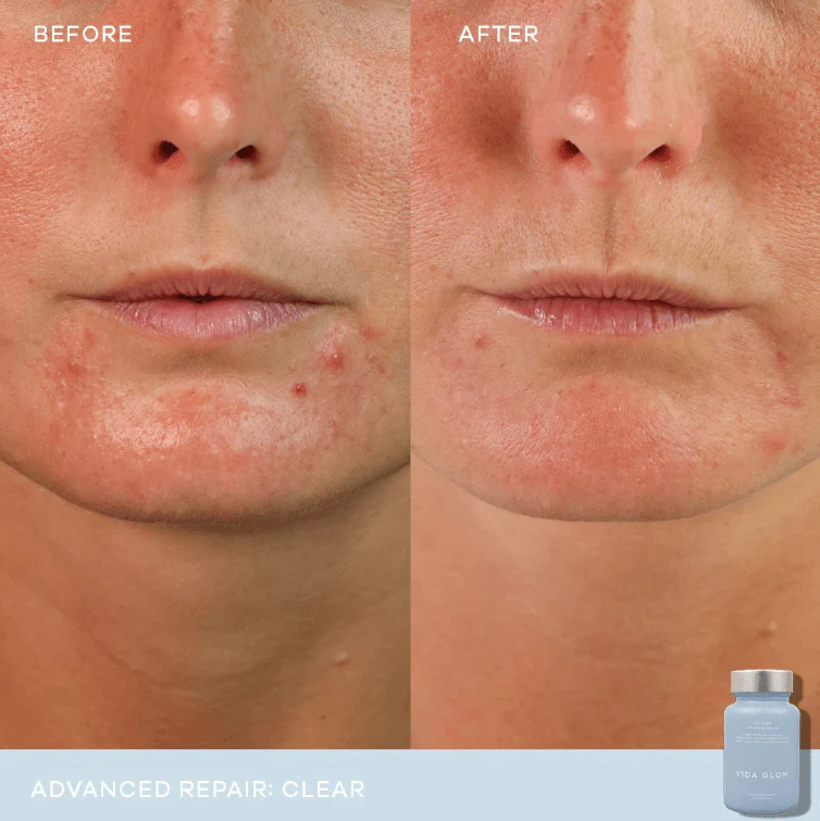 Vida Glow Clear Advanced Repair - 30 capsules 2 Pack - Image 3
