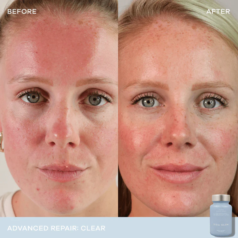 Vida Glow Clear Advanced Repair - 30 capsules 3 Pack - Image 2