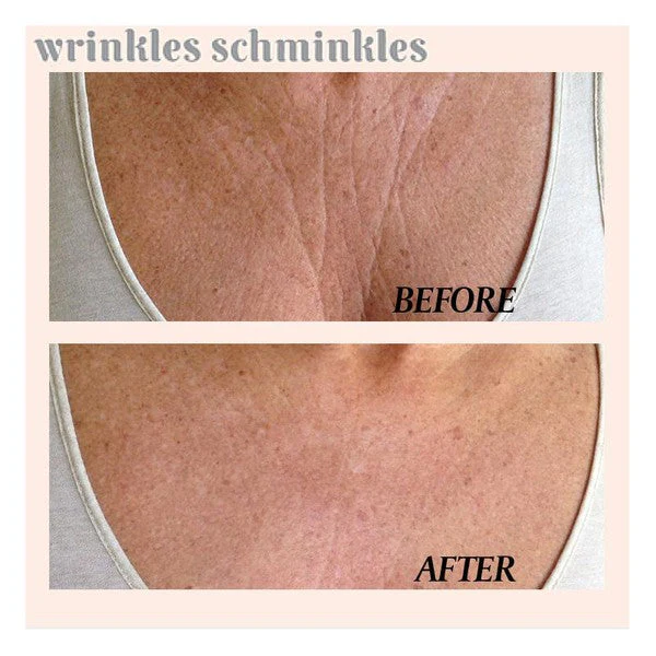 Wrinkles Schminkles Chest Wrinkle Patch - Image 3