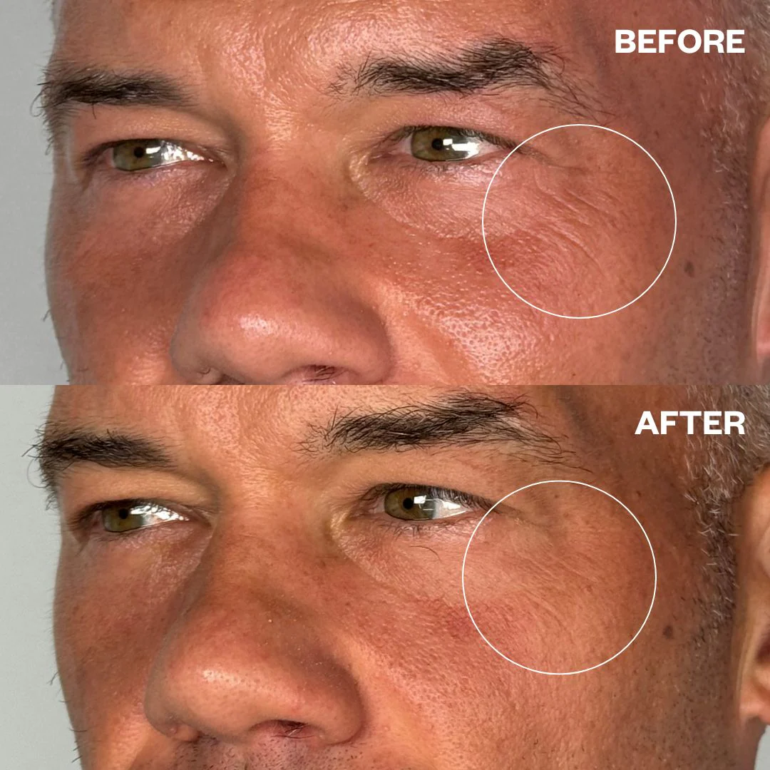 Wrinkles Schminkles Men's Pro Eye Wrinkle Patches - 3 Pairs - Image 4