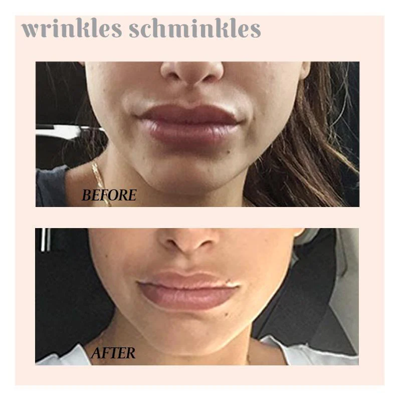 Wrinkles Schminkles Mouth and Lip Wrinkle Patch - 1 Patch - Image 3