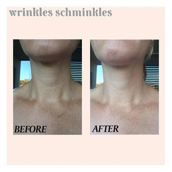 Wrinkles Schminkles Neck Wrinkle Patch - Image 2