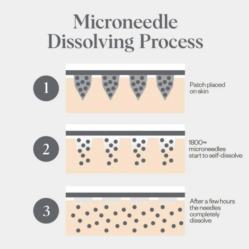 Wrinkles Schminkles Self-Dissolving Microneedle Patches - 4 Pack - Image 3